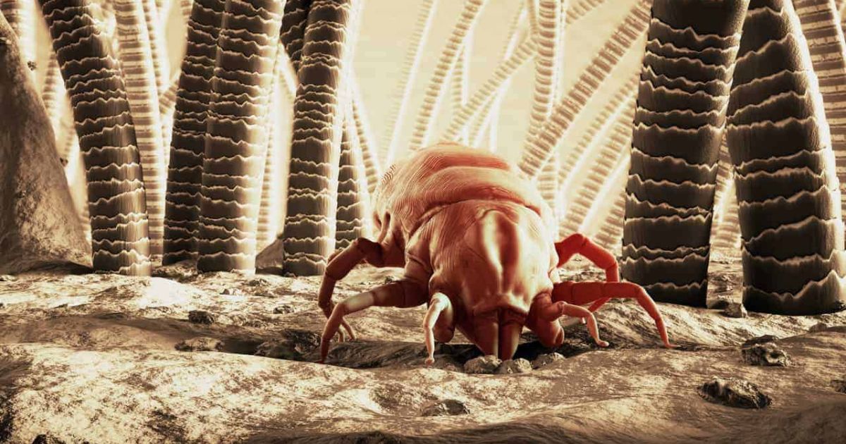 Best Bedding for Dust Mite Allergy (3)